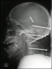 skull-1.jpg